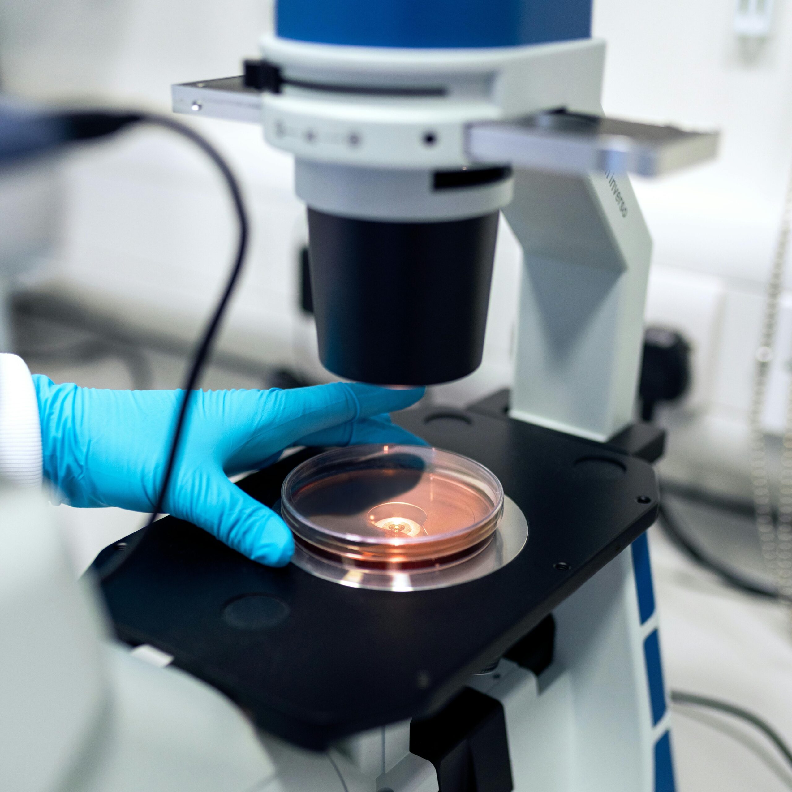 ac. anti coccidioides immitis igg/igm